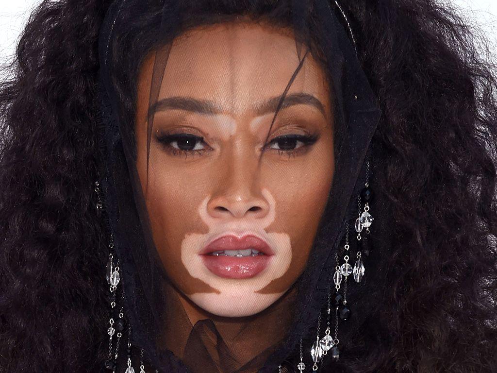 Winnie Harlow ‘It’s Beautiful That the Age of Cookie