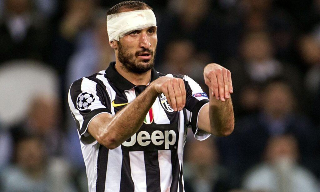 Px KB Chiellini