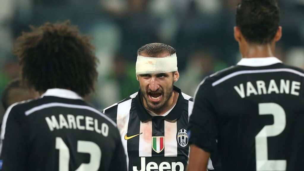 PsBattle Giorgio Chiellini in yesterday’s game betwen Juventus