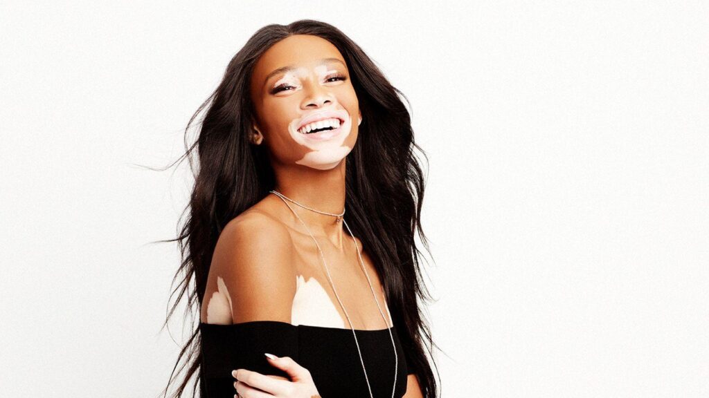 Why Model Winnie Harlow Hates Trying on Clothes